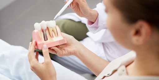 implantes-dentales-en-granada Implantes dentales en Granada - cirugía dental en granada
