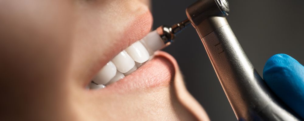 Revisión y diagnóstico dental Granada