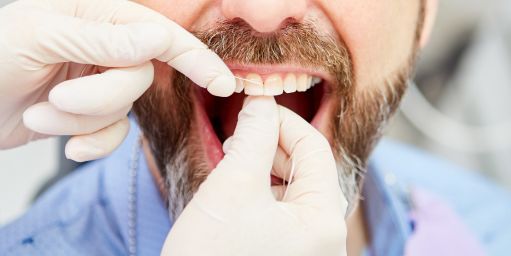 mantenimiento-periodontal-granada Mantenimiento periodontal Granada