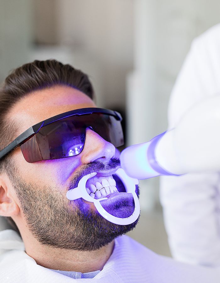 blanqueamiento-dental-1 blanqueamiento dental