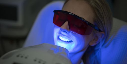 blanqueamiento-dental Blanqueamiento dental